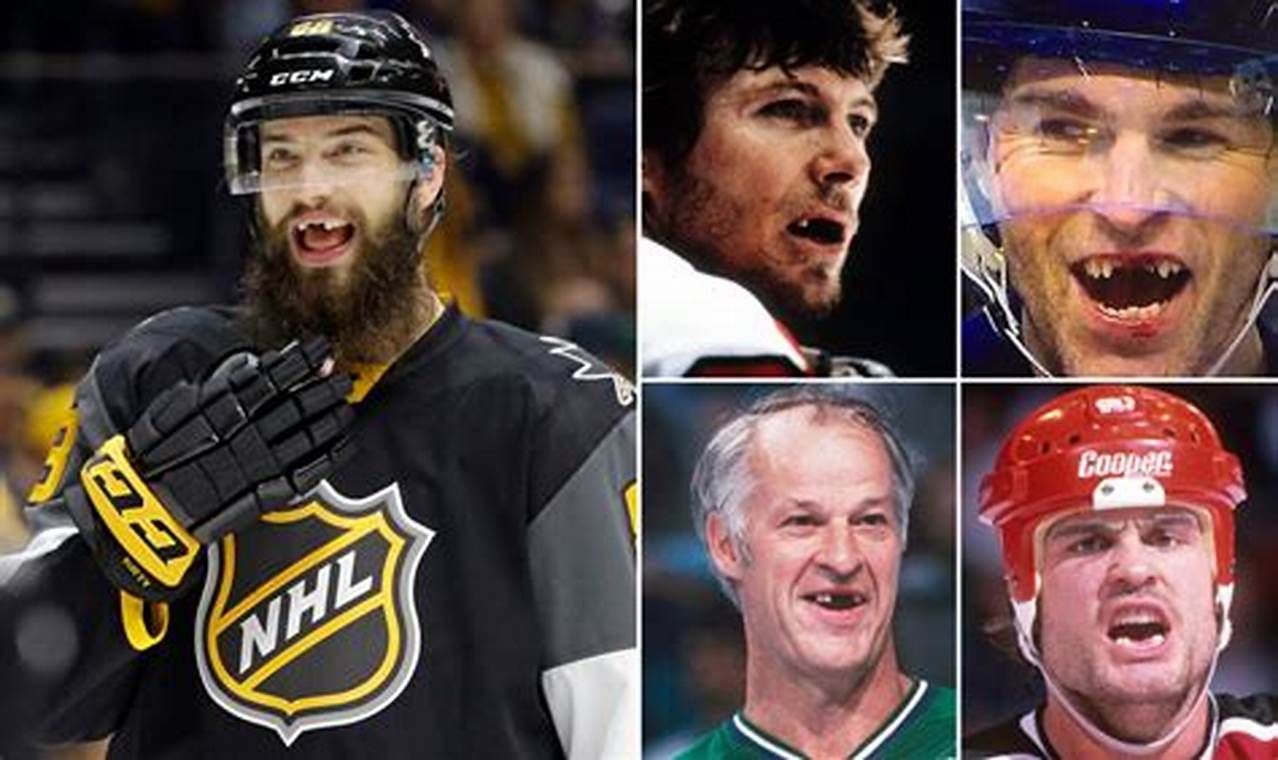 Hockey & Teeth: Why Do Hockey Players Lose Teeth? | Your Ultimate Source for Hockey Updates, Training Guides, and Equipment Recommendations